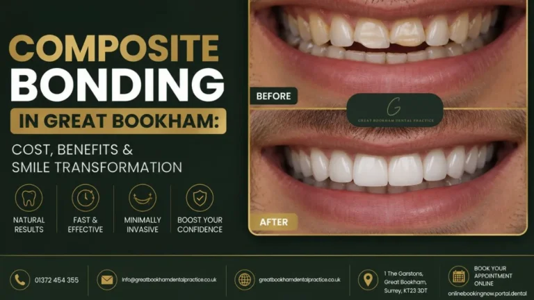 Composite bonding treatment in Great Bookham for chipped, uneven, or stained teeth smile enhancement.