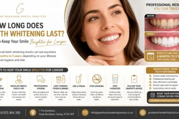 How-Long-Does-Teeth-Whitening-Last