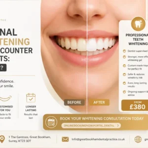 Professional-Teeth-Whitening-vs-Over-the-Counter-Whitening Kits
