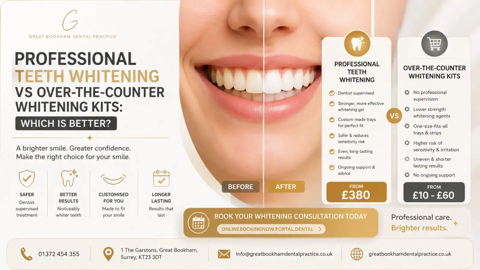 Professional-Teeth-Whitening-vs-Over-the-Counter-Whitening Kits